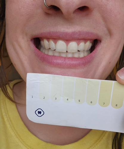 Dr. Dent Purple Teeth Whitening Strips for Stain Removal