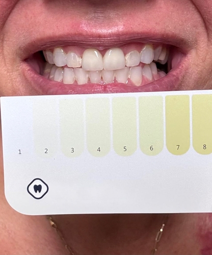 Dr. Dent Purple Teeth Whitening Strips for Stain Removal